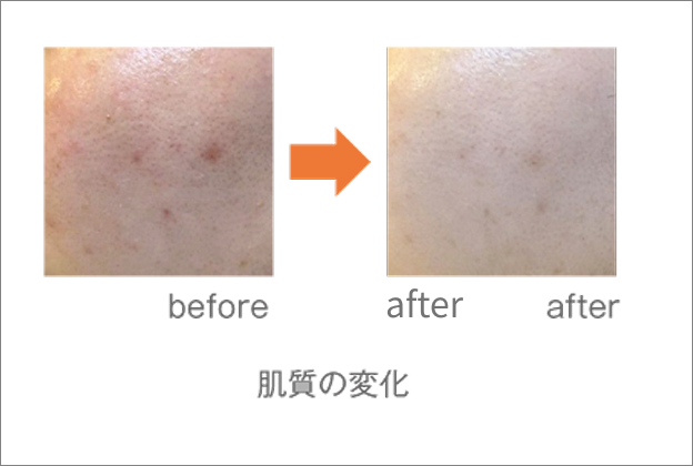 ウルトラファインバブル生成装置